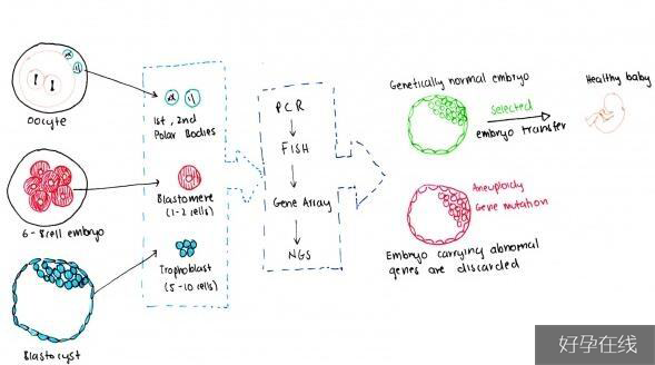 pgs胚胎植入前遗传学筛查的过程