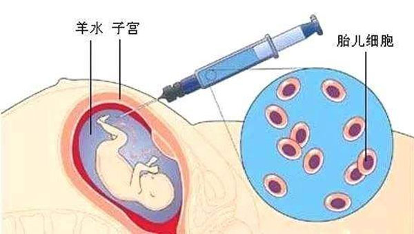 羊水量多少才是正常的