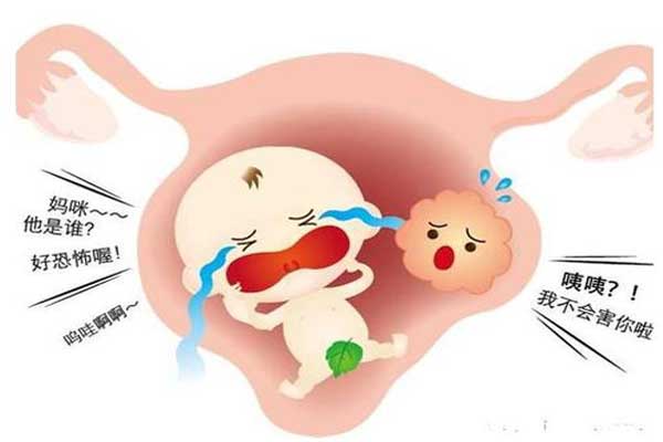 子宫肌瘤致病因素分析